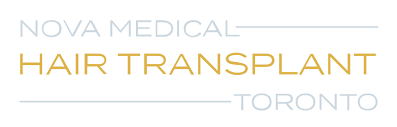 Hair Transplant Toronto | Nova Medical Toronto
